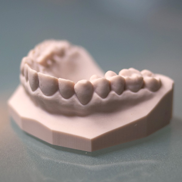 Dentalabdruck mit Asiga PlasPink gedruckt auf einem Asiga Freeform PRO